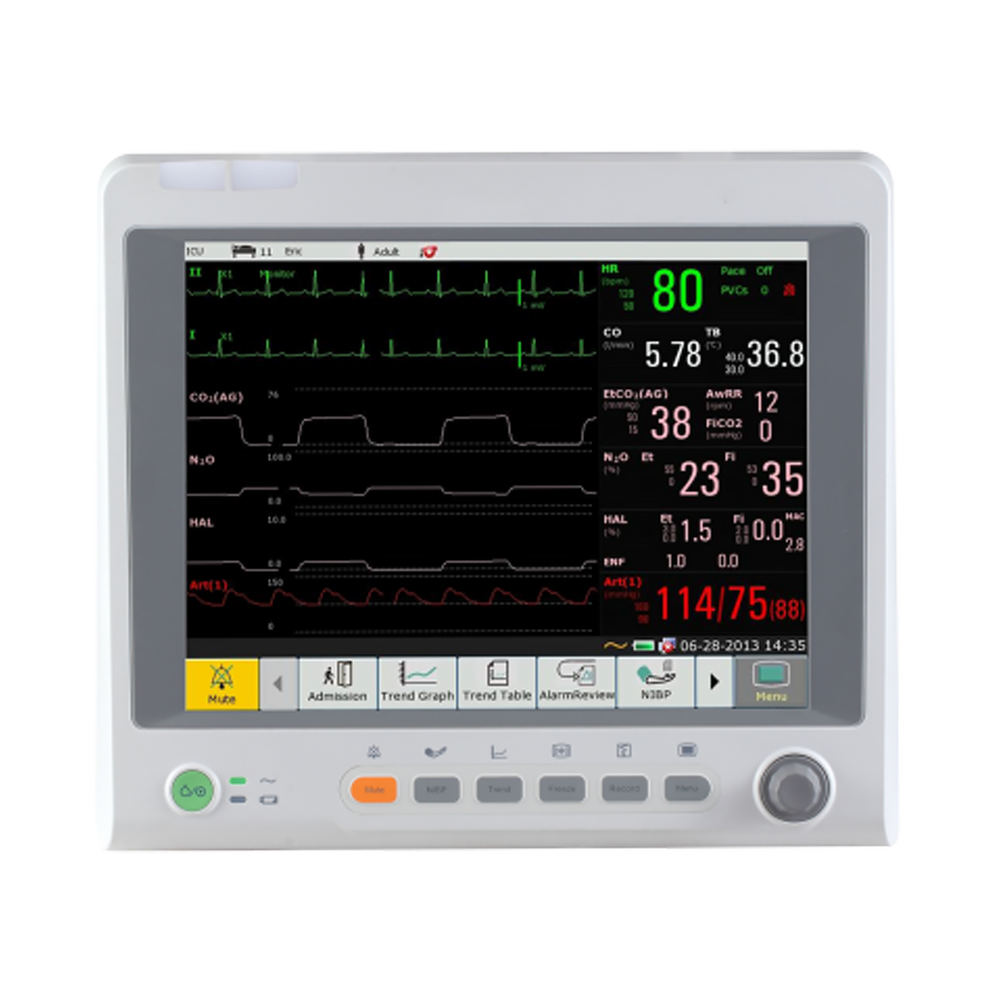 Edan iM70 Touch Patient Monitor