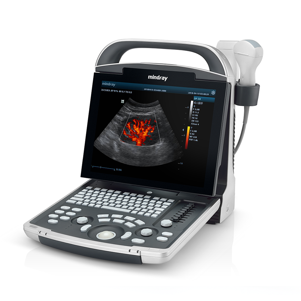 Mindray DP-30 Ultrasound System