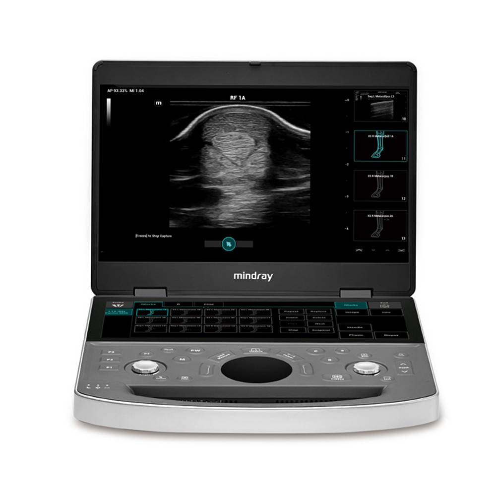 Mindray Vetus EQ Ultrasound System