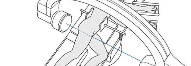 C-Arm Positioning in the OR: Best Practices for Efficient Workflow