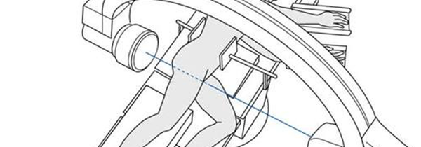 C-Arm Positioning in the OR: Best Practices for Efficient Workflow