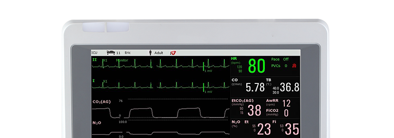 Edan iM70 Patient Monitor: Premium Features for Critical Care