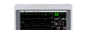 Edan iM70 Patient Monitor: Premium Features for Critical Care