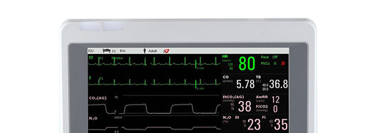 Edan iM70 Patient Monitor: Premium Features for Critical Care