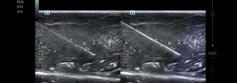 Ultrasound for MSK: What Features Matter Most?