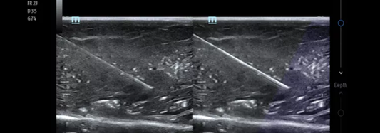 Ultrasound for MSK: What Features Matter Most?
