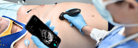 Mindray TE Air: The First Wireless Transducer That Connects to a Full Ultrasound System