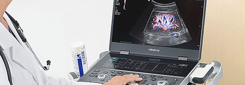 Mindray MX8 vs. MX7: What's New and What's Different?