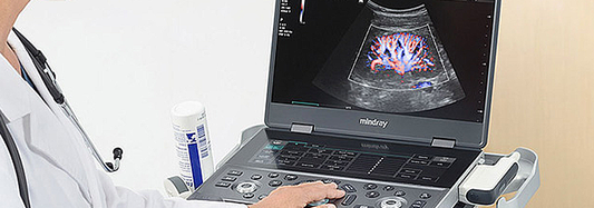 Mindray MX8 vs. MX7: What's New and What's Different?