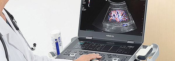 Mindray MX8 vs. MX7: What's New and What's Different?