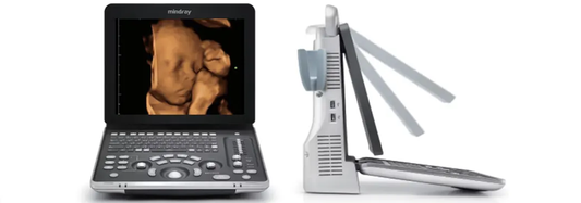 Mindray Z60: Portable Color Doppler Ultrasound That Goes Where You Need It