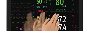 Patient Monitoring 101: Choosing the Right System for Your Facility