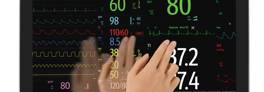 Patient Monitoring 101: Choosing the Right System for Your Facility