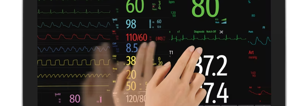 Patient Monitoring 101: Choosing the Right System for Your Facility