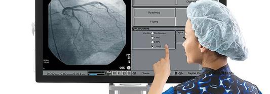 C-Arm for Vascular Surgery: Key Specifications That Define Performance