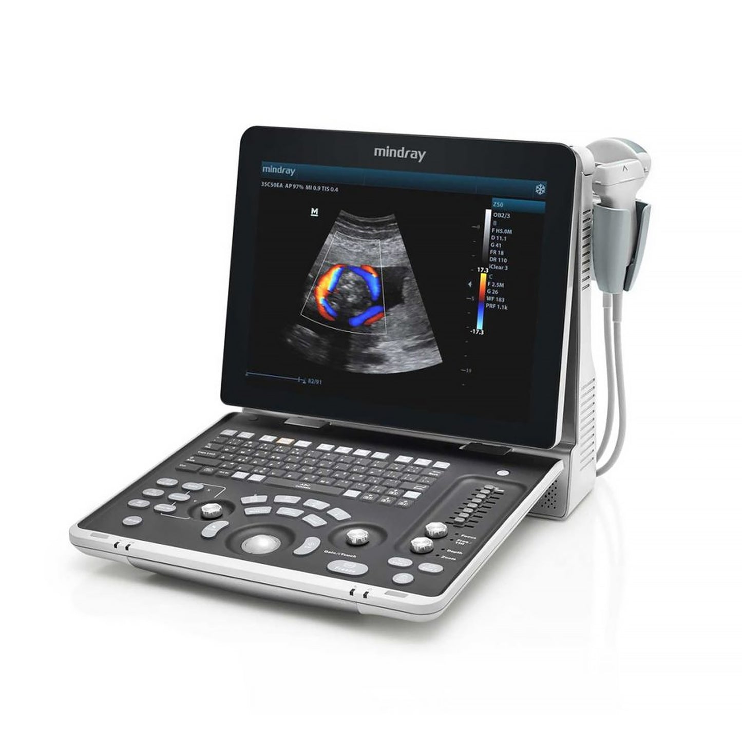 Mindray Z60 Ultrasound System