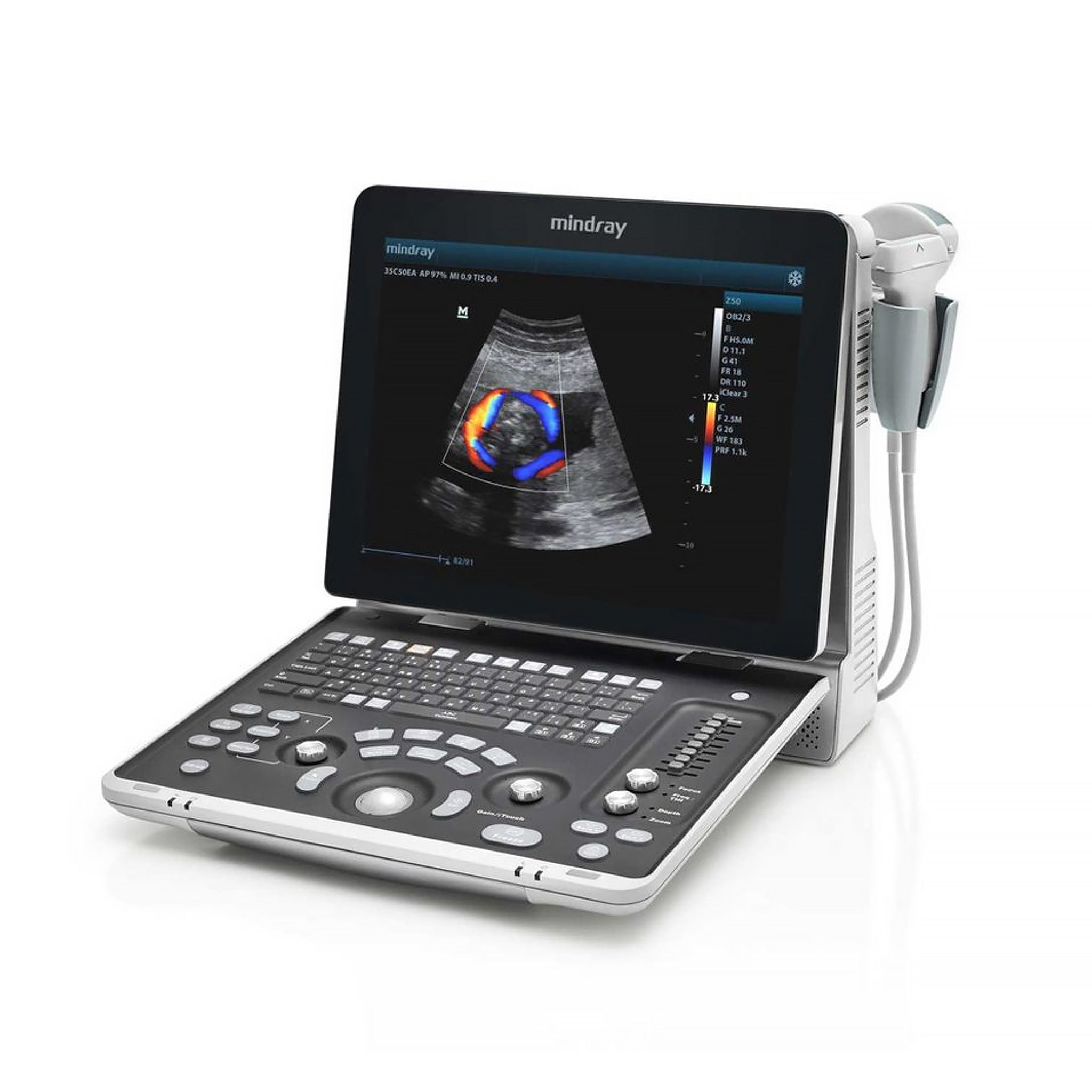 Mindray Z60 Ultrasound System – Equipped MD