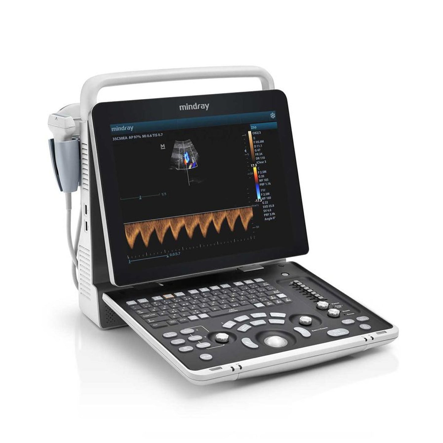 Mindray Z60 Ultrasound System