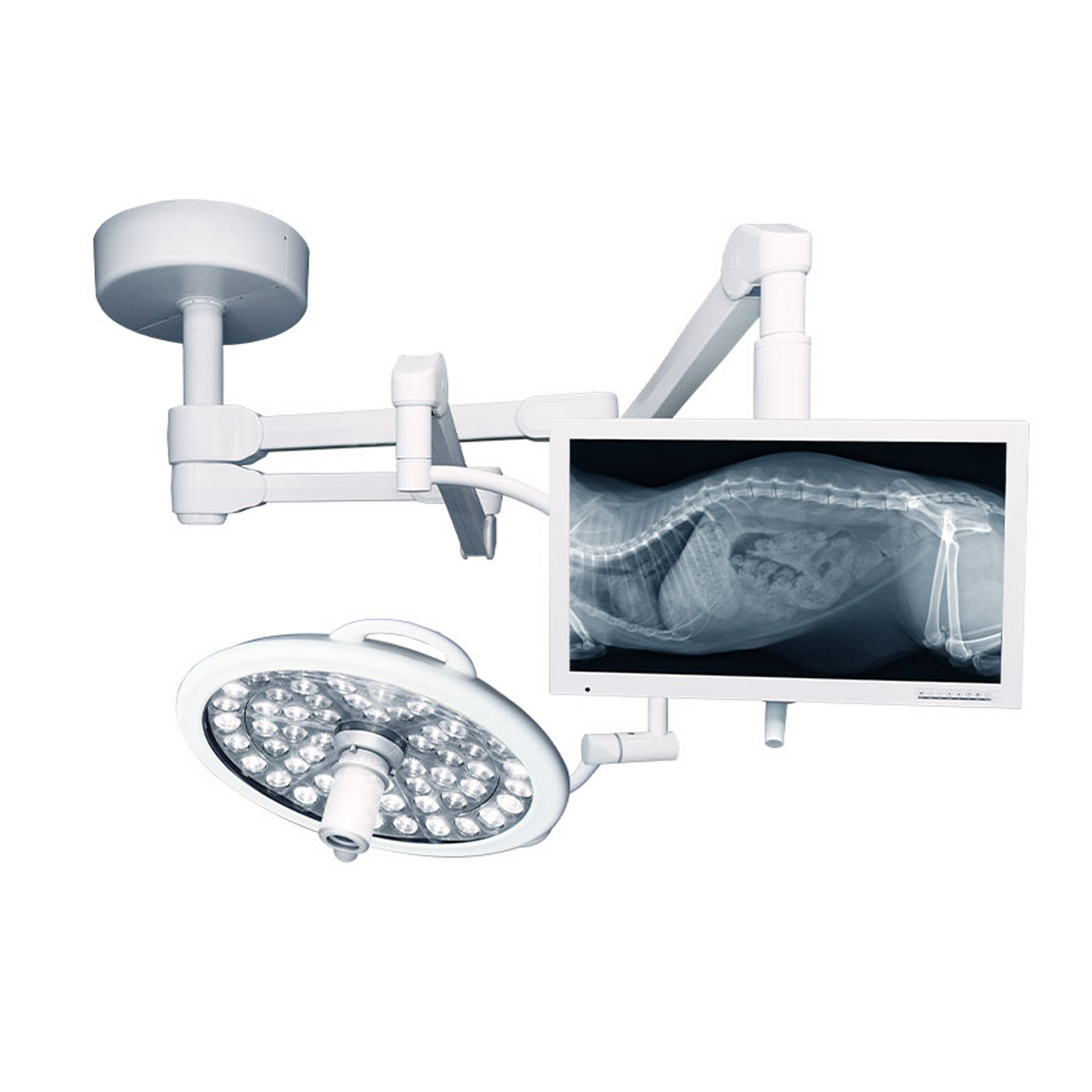 Nuvo VistOR MS LED Surgical Lights