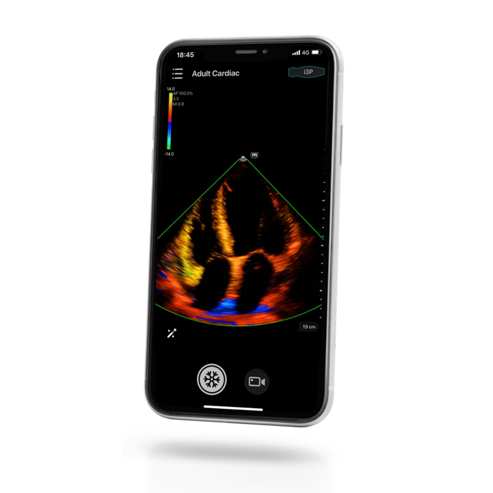 Mindray TE Air i3P Ultrasound System