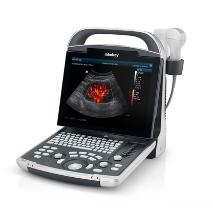 Mindray DP-30 Ultrasound System