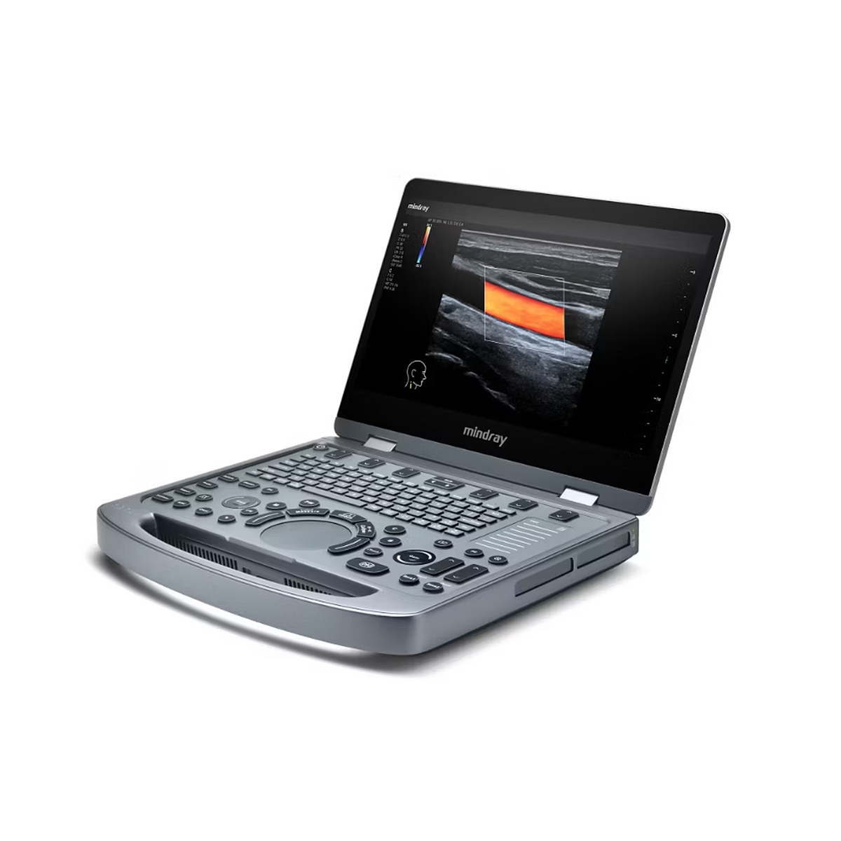 Mindray MX3 Ultrasound System