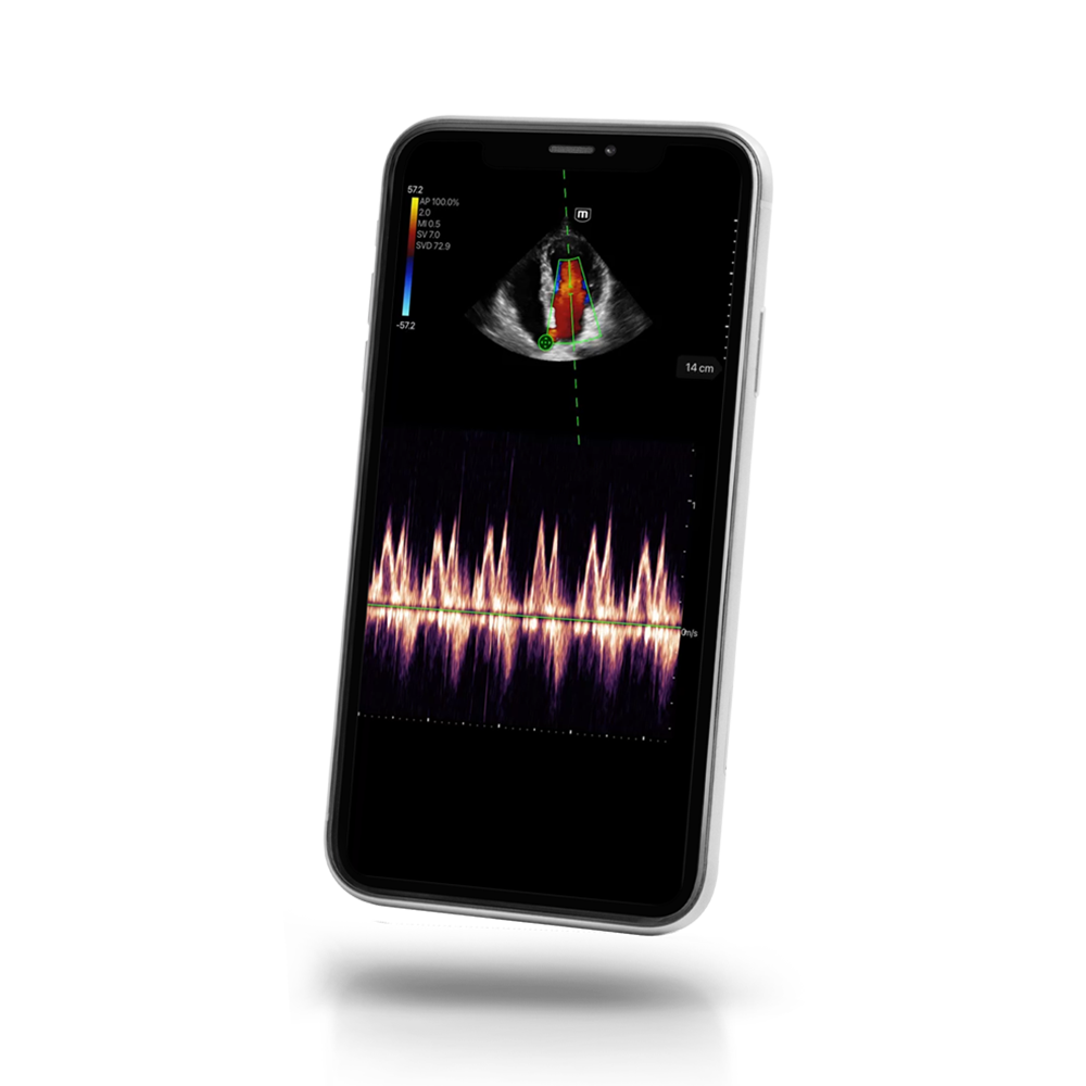 Mindray TE Air e5M Ultrasound System