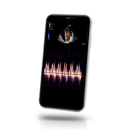Mindray TE Air e5M Ultrasound System