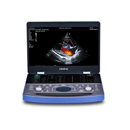 Mindray Vetus E7 Ultrasound System
