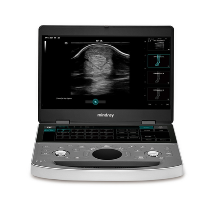 Mindray Vetus EQ Ultrasound System