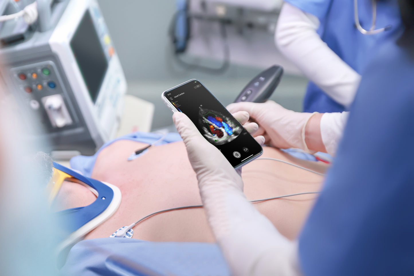 Mindray TE Air e5M Ultrasound System
