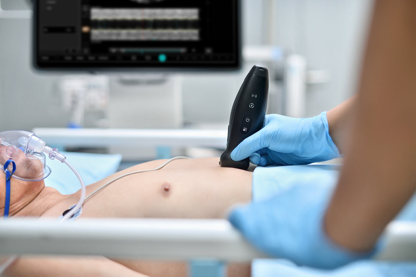 Mindray TE Air e5M Ultrasound System