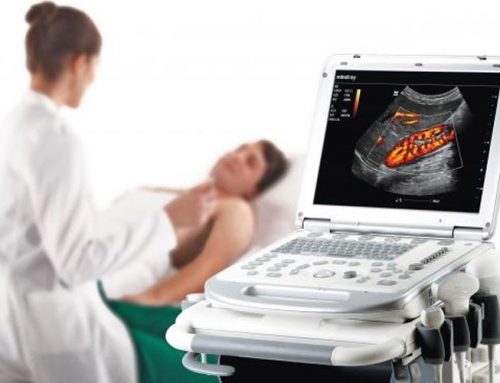 Ultrasound Rentals