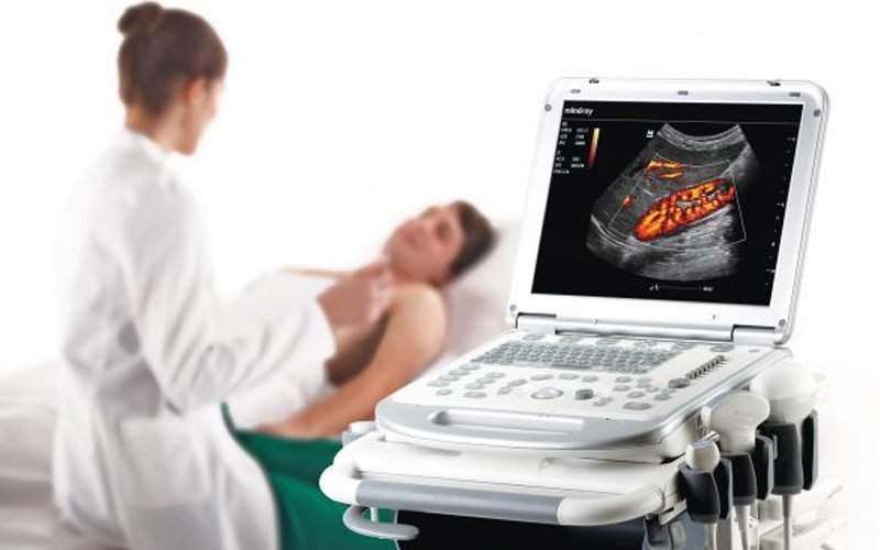 Ultrasound Rentals